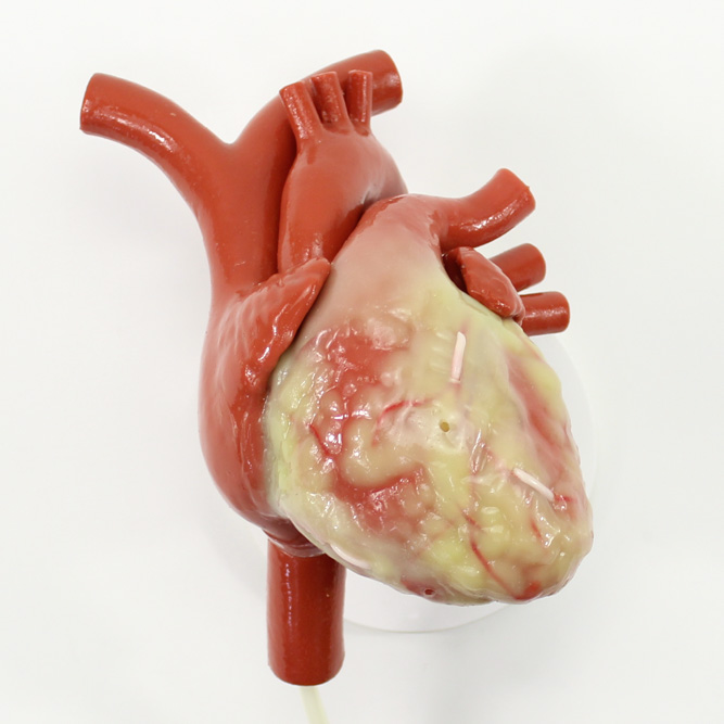 CABG Beating Heart with Ancillary (#1339)