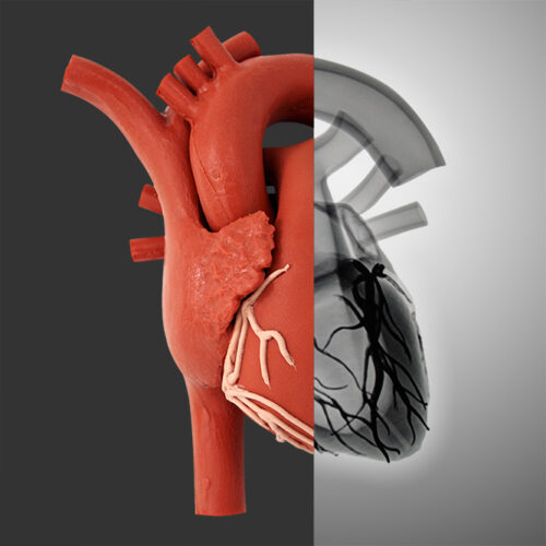 Fluoroscopic Heart (#1396)