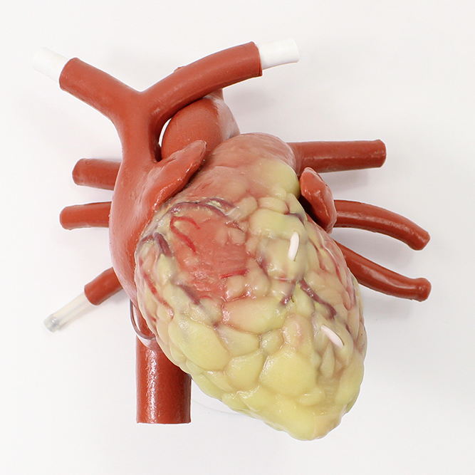 MICS Mitral Larger Adult CABG Beating Heart with Ancillary (#1407)