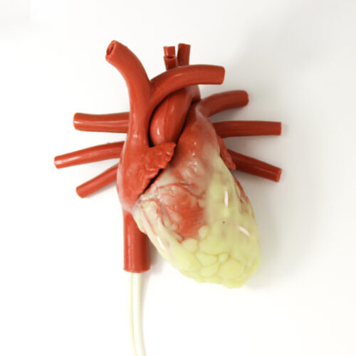 Larger Adult CABG Beating Heart with Ancillary (#1450)