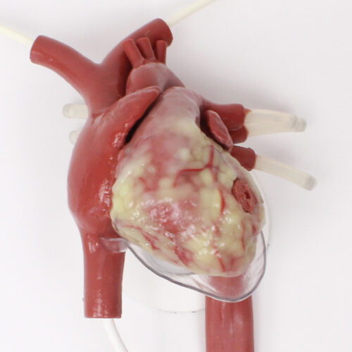 Trauma Thoracotomy Beating Heart with Wound (#1477)