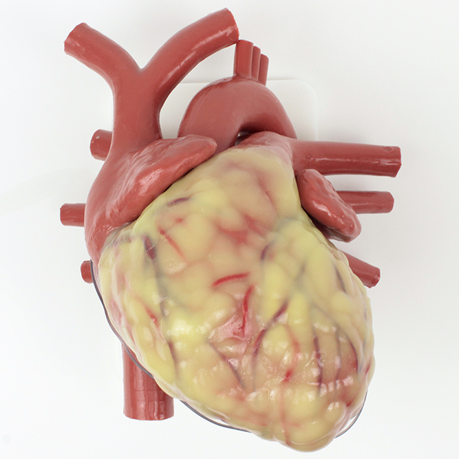 Largest Adult Heart (#1497)