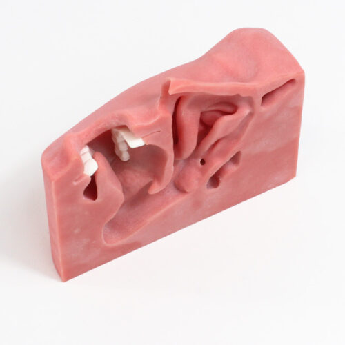 Replacement Sinus & Tonsil Tissue Insert (#9026)